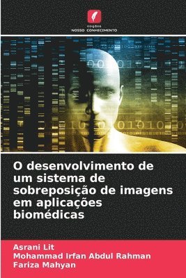 bokomslag O desenvolvimento de um sistema de sobreposição de imagens em aplicações biomédicas