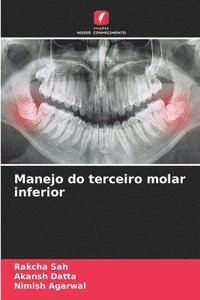 bokomslag Manejo do terceiro molar inferior