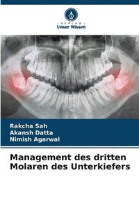 bokomslag Management des dritten Molaren des Unterkiefers