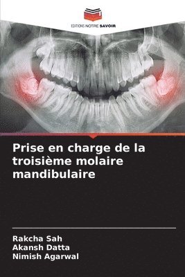 Rakcha Sah, Akansh Datta, Nimish Agarwal, RAKCHA SAH, AKANSH DATTA - Prise en charge de la troisième molaire mandibulaire, Häftad