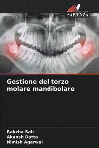 bokomslag Gestione del terzo molare mandibolare