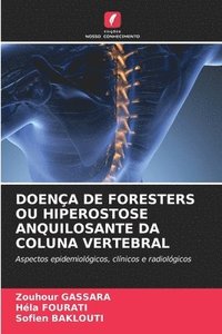 bokomslag Doença de Foresters Ou Hiperostose Anquilosante Da Coluna Vertebral