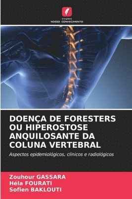 bokomslag Doença de Foresters Ou Hiperostose Anquilosante Da Coluna Vertebral