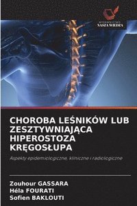 bokomslag Choroba Le?ników Lub Zesztywniaj?ca Hiperostoza Kr?goslupa