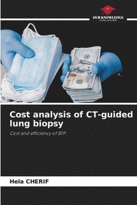Cost analysis of CT-guided lung biopsy