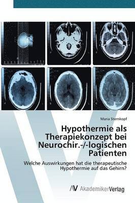 bokomslag Hypothermie als Therapiekonzept bei Neurochir.-/-logischen Patienten