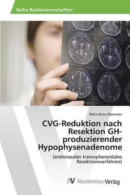 bokomslag CVG-Reduktion nach Resektion GH-produzierender Hypophysenadenome