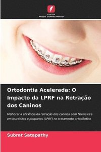 bokomslag Ortodontia Acelerada: O Impacto da LPRF na Retração dos Caninos