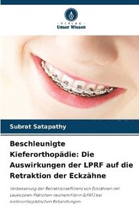 bokomslag Beschleunigte Kieferorthopädie