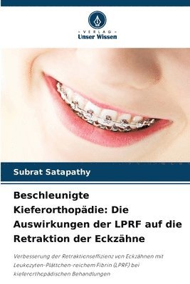 Beschleunigte Kieferorthopädie