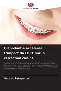 bokomslag Orthodontie accélérée: L'impact du LPRF sur la rétraction canine