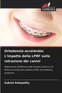 bokomslag Ortodonzia accelerata: L'impatto della LPRF sulla retrazione dei canini