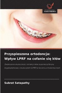 bokomslag Przyspieszona ortodoncja: Wplyw LPRF na cofanie si? klów