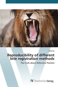 bokomslag Reproducibility of different bite registration methods