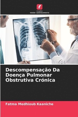 bokomslag Descompensação Da Doença Pulmonar Obstrutiva Crónica
