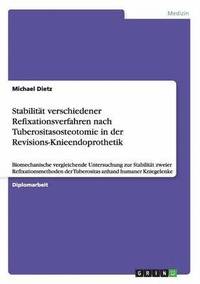 bokomslag Stabilität verschiedener Refixationsverfahren nach Tuberositasosteotomie in der Revisions-Knieendoprothetik