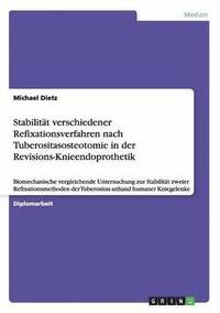 bokomslag Stabilitat verschiedener Refixationsverfahren nach Tuberositasosteotomie in der Revisions-Knieendoprothetik