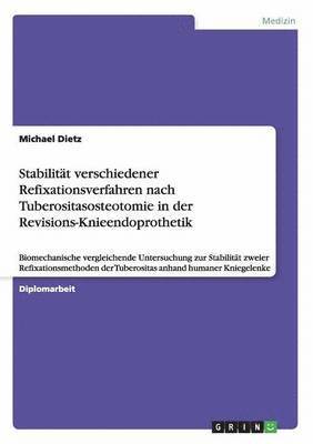 bokomslag Stabilität verschiedener Refixationsverfahren nach Tuberositasosteotomie in der Revisions-Knieendoprothetik