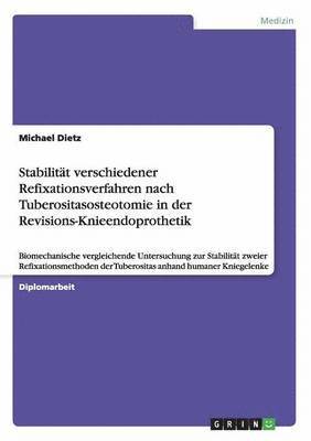 Stabilitt verschiedener Refixationsverfahren nach Tuberositasosteotomie in der Revisions-Knieendoprothetik 1