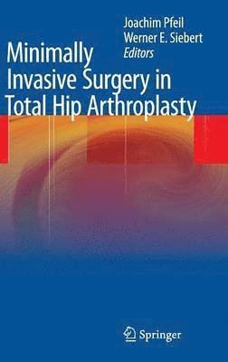 Minimally Invasive Surgery in Total Hip Arthroplasty 1