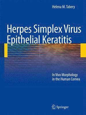 bokomslag Herpes Simplex Virus Epithelial Keratitis