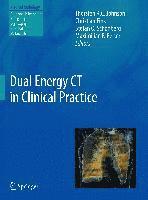 Dual Energy CT in Clinical Practice