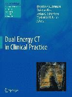 Dual Energy CT in Clinical Practice 1