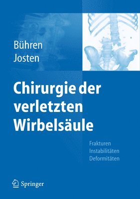 bokomslag Chirurgie der verletzten Wirbelsule