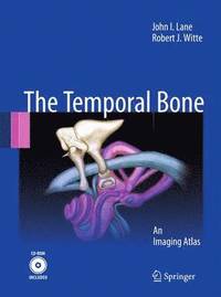 bokomslag Temporal Bone