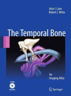 Temporal Bone 1