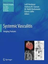 bokomslag Systemic Vasculitis