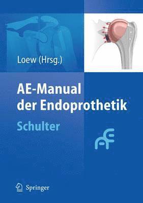 AE-Manual der Endoprothetik 1