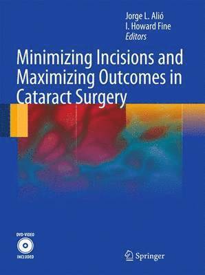 Minimizing Incisions and Maximizing Outcomes in Cataract Surgery 1