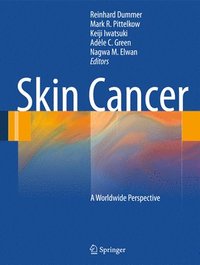 bokomslag Skin Cancer - A World-Wide Perspective