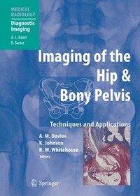 bokomslag Imaging of the Hip & Bony Pelvis