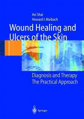 Avi Shai, Howard I. Maibach - Wound Healing and Ulcers of the Skin, Häftad
