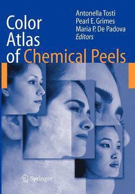 Color Atlas of Chemical Peels 1