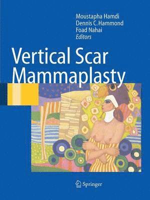 Vertical Scar Mammaplasty 1
