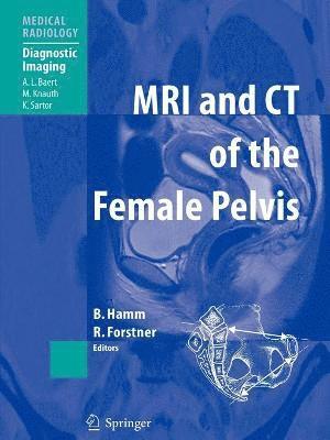MRI and CT of the Female Pelvis 1