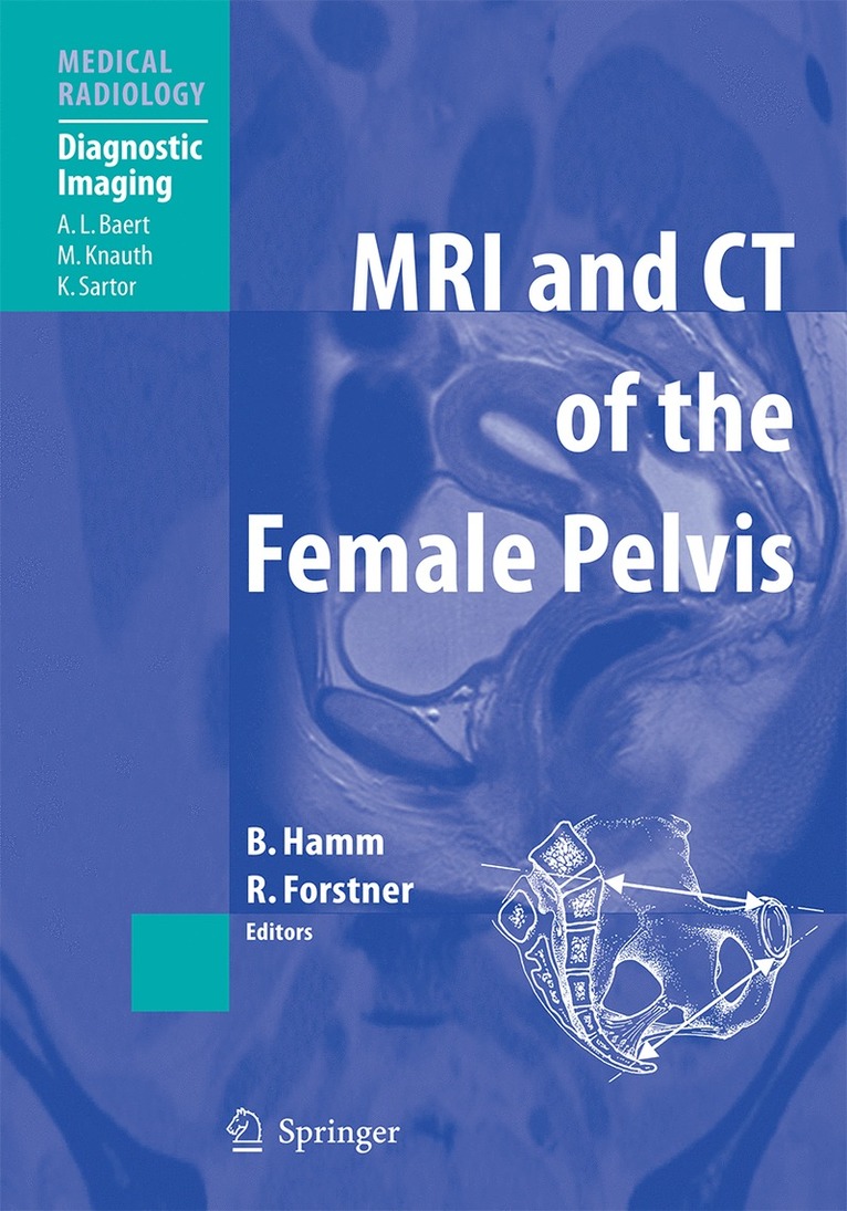 MRI and CT of the Female Pelvis 1