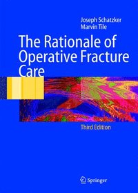 bokomslag The Rationale of Operative Fracture Care