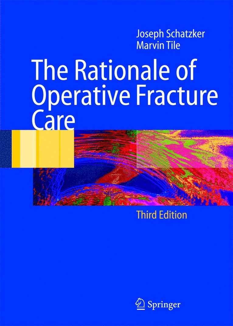 Joseph Schatzker, Marvin Tile - Rationale of Operative Fracture Care, Häftad