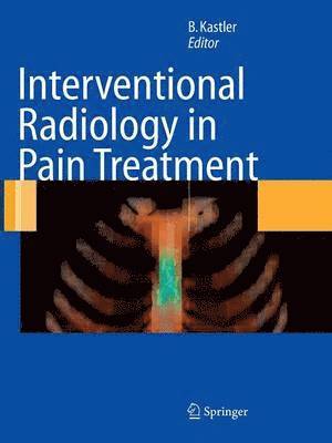 Interventional Radiology in Pain Treatment 1