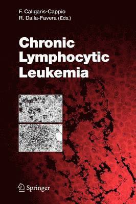 Chronic Lymphocytic Leukemia 1