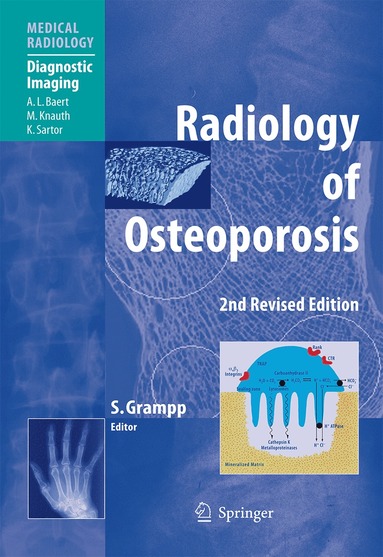 bokomslag Radiology of Osteoporosis