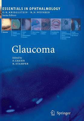 Glaucoma 1