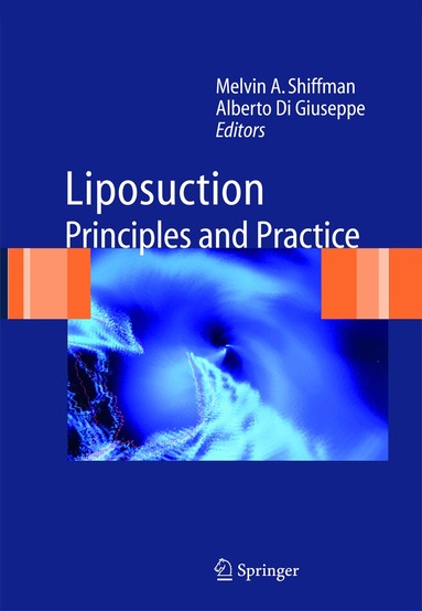 Melvin A. Shiffman, Alberto Di Giuseppe - Liposuction, Häftad