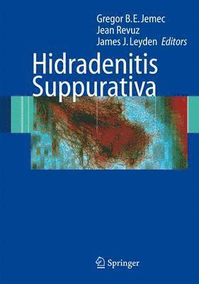 bokomslag Hidradenitis Suppurativa