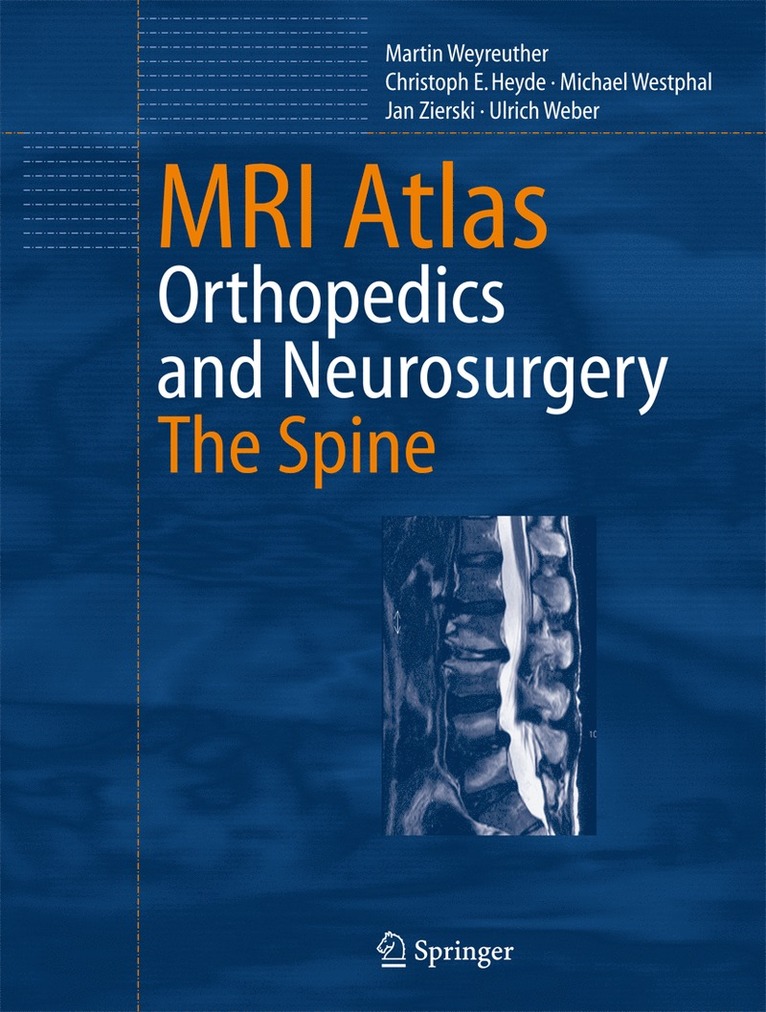 Martin Weyreuther, Christoph E. Heyde, Michael Westphal, Jan Zierski, Ulrich Weber - MRI Atlas, Häftad