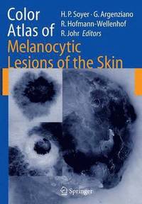 bokomslag Color Atlas of Melanocytic Lesions of the Skin